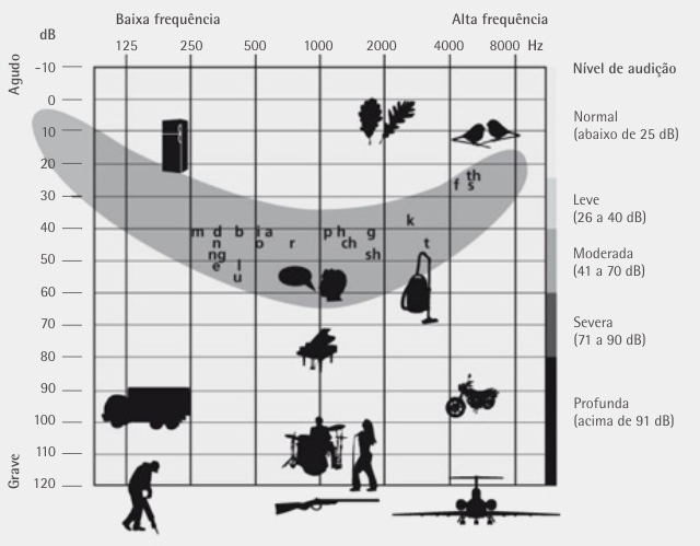 audiograma perda auditiva condutiva